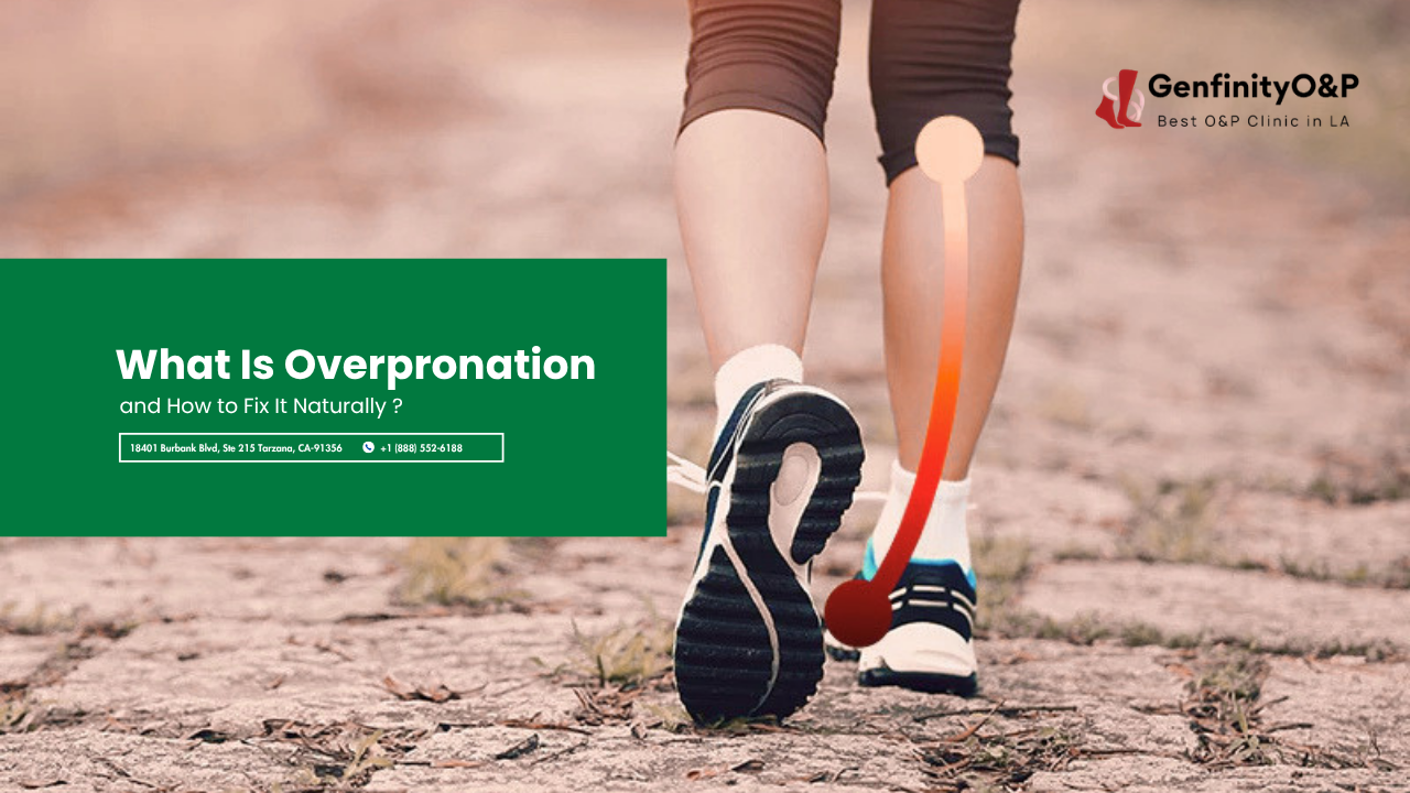 Overpronation